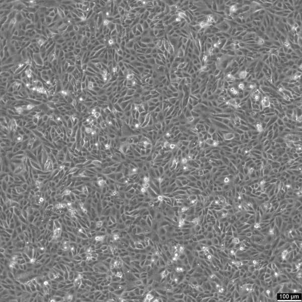 SNU-449 cell