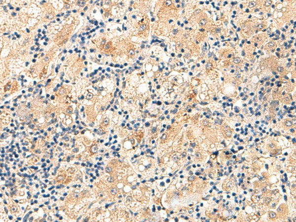 MRPL16 Polyclonal Antibody – Figure 1 of 3