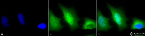 Rabbit Anti-SOD1 (Cu/Zn) Antibody used in Immunocytochemistry/Immunofluorescence (ICC/IF) on Human HeLa Cells (SPC-115)