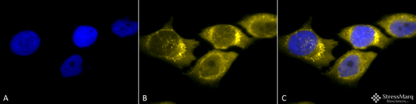 Rabbit Anti-SOD2 (Mn) Antibody used in Immunocytochemistry/Immunofluorescence (ICC/IF) on Human Cervical cancer cell line (HeLa) (SPC-117)