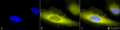 Rabbit Anti-Ubiquitin Antibody used in Immunocytochemistry/Immunofluorescence (ICC/IF) on Human Heat Shocked Cervical cancer cell line (HeLa) (SPC-119)
