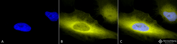 Rabbit Anti-Ubiquitin Antibody used in Immunocytochemistry/Immunofluorescence (ICC/IF) on Human Heat Shocked Cervical cancer cell line (HeLa) (SPC-119)
