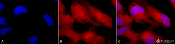 Rabbit Anti-Erk1/2 Antibody used in Immunocytochemistry/Immunofluorescence (ICC/IF) on Human Cervical cancer cell line (HeLa) (SPC-120)