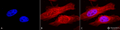 Rabbit Anti-Alpha B Crystallin Antibody used in Immunocytochemistry/Immunofluorescence (ICC/IF) on Human Heat Shocked Cervical cancer cell line (HeLa) (SPC-126)