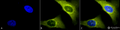 Rabbit Anti-Rab4 Antibody used in Immunocytochemistry/Immunofluorescence (ICC/IF) on Human Heat Shocked Cervical cancer cell line (HeLa) (SPC-141)