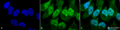 Rabbit Anti-Phosphothreonine Antibody used in Immunocytochemistry/Immunofluorescence (ICC/IF) on Cervical cancer cell line (HeLa) (SPC-154)