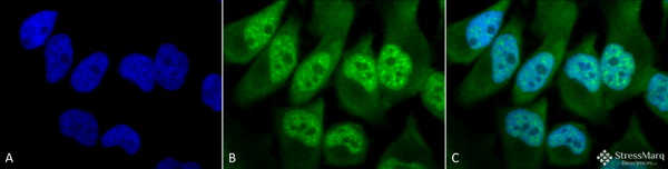 Rabbit Anti-Phosphothreonine Antibody used in Immunocytochemistry/Immunofluorescence (ICC/IF) on Cervical cancer cell line (HeLa) (SPC-154)