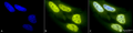 Rabbit Anti-Acetylated Lysine Antibody used in Immunocytochemistry/Immunofluorescence (ICC/IF) on Heat Shocked Cervical cancer cell line (HeLa) (SPC-155)