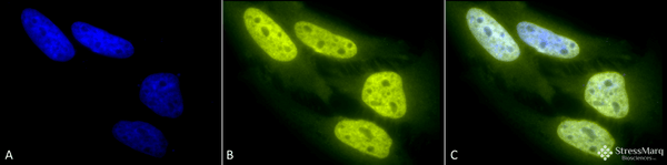 Rabbit Anti-Acetylated Lysine Antibody used in Immunocytochemistry/Immunofluorescence (ICC/IF) on Heat Shocked Cervical cancer cell line (HeLa) (SPC-155)