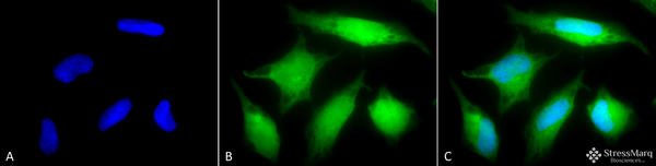 Rabbit Anti-Rab5 Antibody used in Immunocytochemistry/Immunofluorescence (ICC/IF) on Cervical cancer cell line (HeLa) (SPC-168)