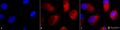 Rabbit Anti-TNF-R1 Antibody used in Immunocytochemistry/Immunofluorescence (ICC/IF) on Cervical cancer cell line (HeLa) (SPC-170)