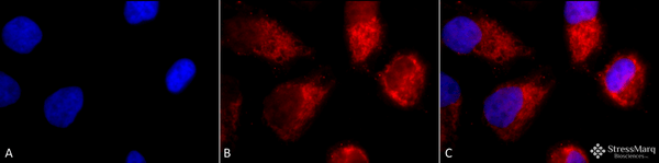 Rabbit Anti-TNF-R1 Antibody used in Immunocytochemistry/Immunofluorescence (ICC/IF) on Cervical cancer cell line (HeLa) (SPC-170)