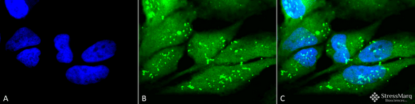 Rabbit Anti-p38 Antibody used in Immunocytochemistry/Immunofluorescence (ICC/IF) on Cervical cancer cell line (HeLa) (SPC-172)
