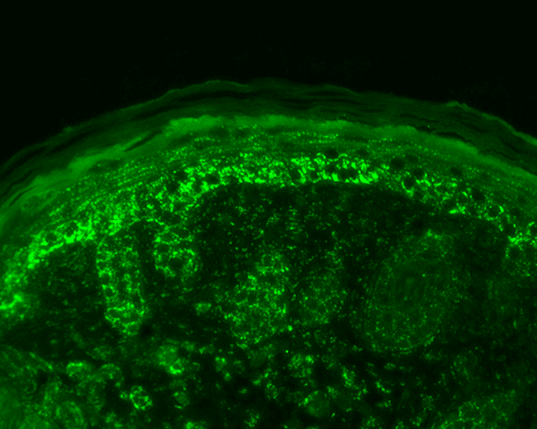 Rabbit Anti-Cpn10 Antibody used in Immunohistochemistry (IHC) on backskin (SPC-193)
