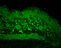 Rabbit Anti-HSP110 Antibody used in Immunohistochemistry (IHC) on backskin (SPC-195)