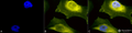 Rabbit Anti-SOD1 (UbetaB) Antibody used in Immunocytochemistry/Immunofluorescence (ICC/IF) on Cervical cancer cell line (HeLa) (SPC-205)