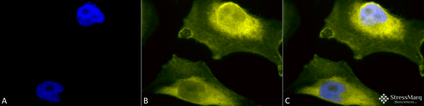 Rabbit Anti-SOD1 (UbetaB) Antibody used in Immunocytochemistry/Immunofluorescence (ICC/IF) on Cervical cancer cell line (HeLa) (SPC-205)