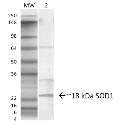 Rabbit Anti-SOD1 (EDI) Antibody used in Western blot (WB) on Lung (SPC-206)