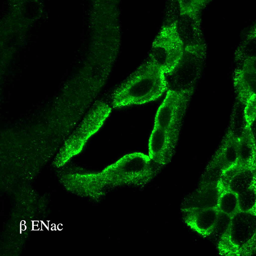 Rabbit Anti-ENaC Antibody used in Immunohistochemistry (IHC) on kidney tissue (SPC-404)