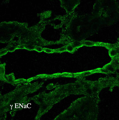 Rabbit Anti-ENaC Antibody used in Immunohistochemistry (IHC) on kidney tissue (SPC-405)