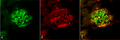 Rabbit Anti-Amyloid Fibrils (OC) Antibody used in Immunohistochemistry (IHC) on Alzheimer's Disease brain (SPC-507)