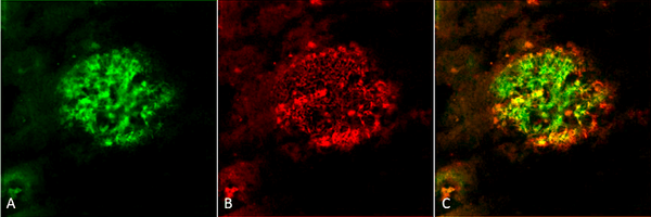 Rabbit Anti-Amyloid Fibrils (OC) Antibody used in Immunohistochemistry (IHC) on Alzheimer's Disease brain (SPC-507)