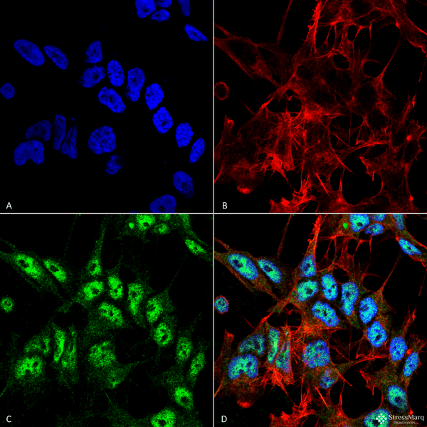 Rabbit Anti-Beclin 1 Antibody used in Immunocytochemistry/Immunofluorescence (ICC/IF) on Neuroblastoma cell line (SK-N-BE) (SPC-600)