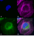 Rabbit Anti-Beclin 1 Antibody used in Immunocytochemistry/Immunofluorescence (ICC/IF) on SK-N-BE (SPC-601)