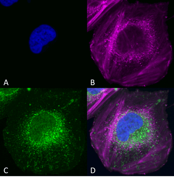 Rabbit Anti-Beclin 1 Antibody used in Immunocytochemistry/Immunofluorescence (ICC/IF) on SK-N-BE (SPC-601)