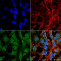 Rabbit Anti-UVRAG Antibody used in Immunocytochemistry/Immunofluorescence (ICC/IF) on Neuroblastoma cell line (SK-N-BE) (SPC-606)