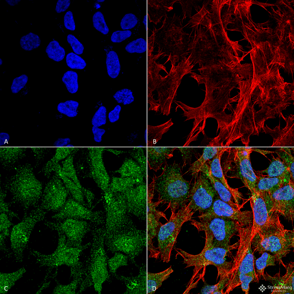 Rabbit Anti-UVRAG Antibody used in Immunocytochemistry/Immunofluorescence (ICC/IF) on Neuroblastoma cell line (SK-N-BE) (SPC-606)