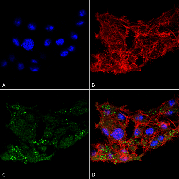 Rabbit Anti-ATG7 Antibody used in Immunocytochemistry/Immunofluorescence (ICC/IF) on Colon carcinoma cell line (RKO) (SPC-610)