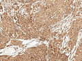 Rabbit Anti-FUNDC1 Antibody used in Immunohistochemistry (IHC) on Brain (SPC-638)