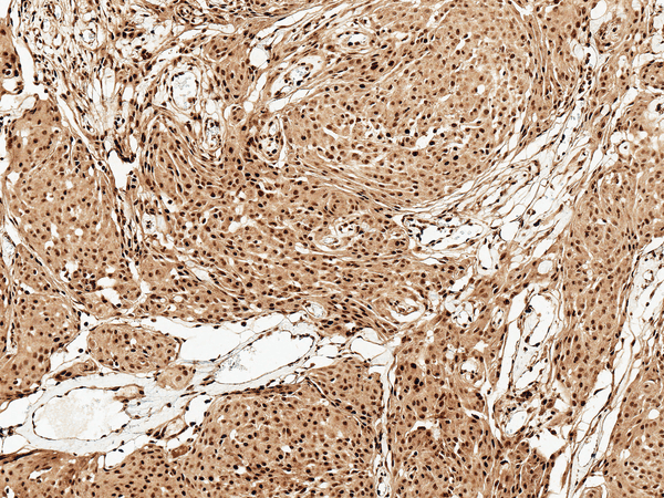 Rabbit Anti-FUNDC1 Antibody used in Immunohistochemistry (IHC) on Brain (SPC-638)