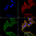 Rabbit Anti-ULK1 Antibody used in Immunocytochemistry/Immunofluorescence (ICC/IF) on Neuroblastoma cell line (SK-N-BE) (SPC-640)