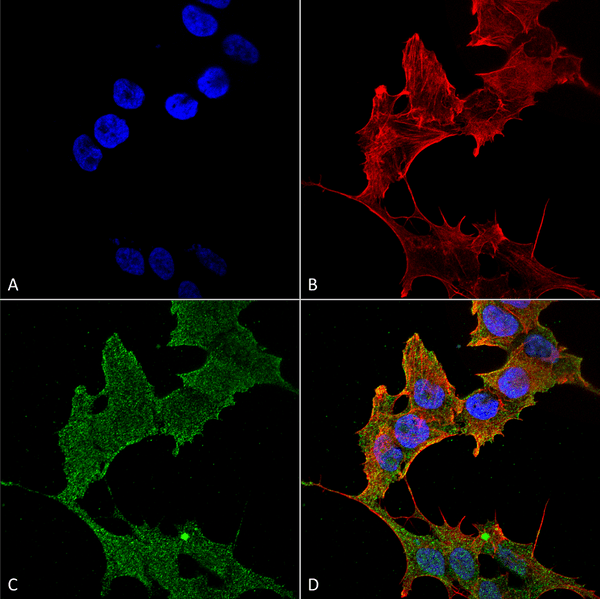 Rabbit Anti-ULK1 Antibody used in Immunocytochemistry/Immunofluorescence (ICC/IF) on Neuroblastoma cell line (SK-N-BE) (SPC-640)