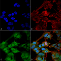 Rabbit Anti-ATG9B Antibody used in Immunocytochemistry/Immunofluorescence (ICC/IF) on Neuroblastoma cell line (SK-N-BE) (SPC-646)