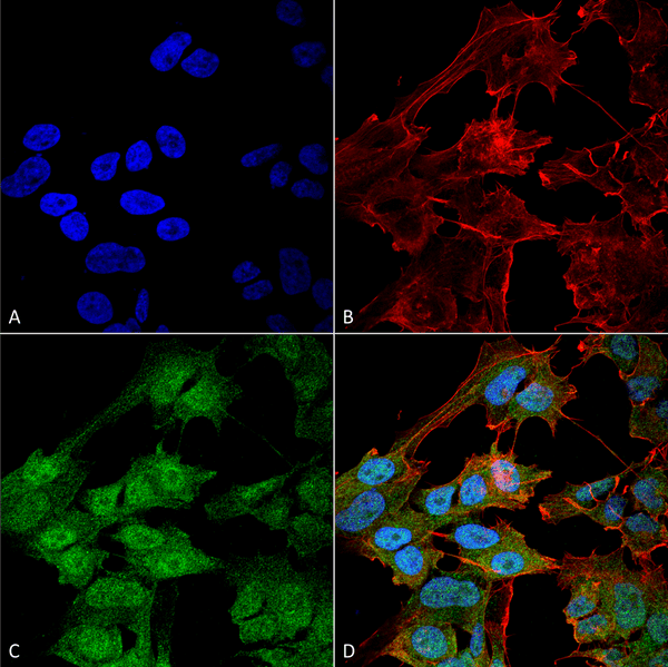 Rabbit Anti-ATG9B Antibody used in Immunocytochemistry/Immunofluorescence (ICC/IF) on Neuroblastoma cell line (SK-N-BE) (SPC-646)