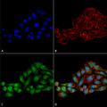 Rabbit Anti-WDR45 Antibody used in Immunocytochemistry/Immunofluorescence (ICC/IF) on Cervical cancer cell line (HeLa) (SPC-651)
