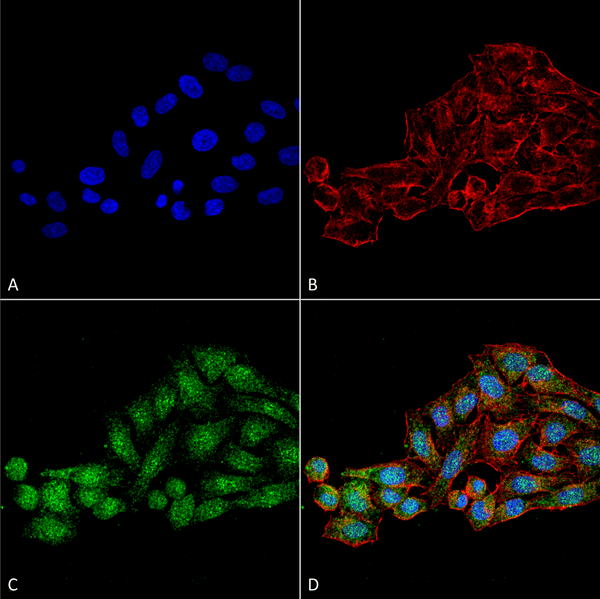 Rabbit Anti-WDR45 Antibody used in Immunocytochemistry/Immunofluorescence (ICC/IF) on Cervical cancer cell line (HeLa) (SPC-651)
