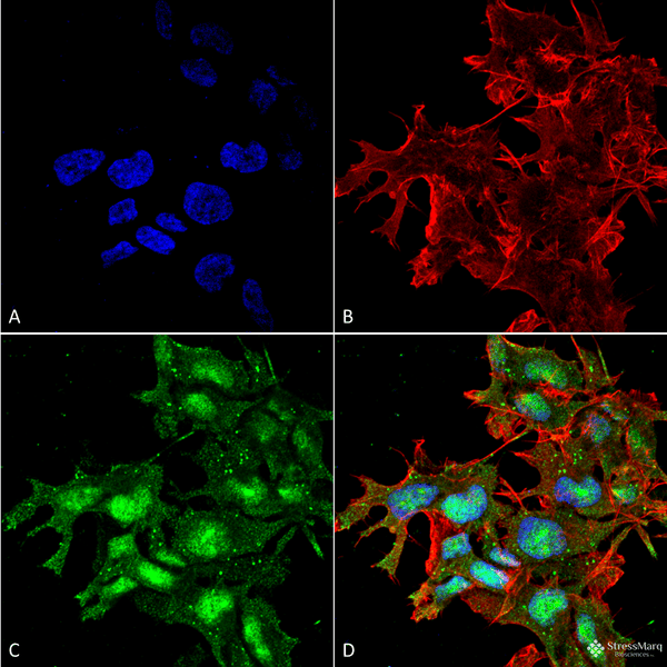 Rabbit Anti-ATG2A Antibody  used in Immunocytochemistry/Immunofluorescence (ICC/IF) on Neuroblastoma cell line (SK-N-BE) (SPC-652)