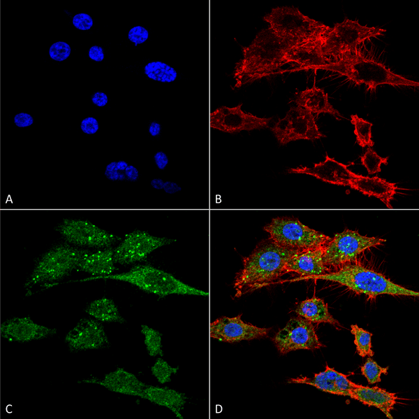 Rabbit Anti-Rubicon Antibody used in Immunocytochemistry/Immunofluorescence (ICC/IF) on Colon carcinoma cell line (RKO) (SPC-668)