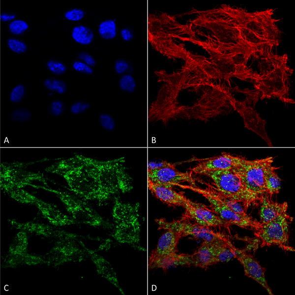 Rabbit Anti-VMP1 Antibody used in Immunocytochemistry/Immunofluorescence (ICC/IF) on Colon carcinoma cell line (RKO) (SPC-680)