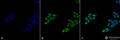 Rabbit Anti-p53 Antibody used in Immunocytochemistry/Immunofluorescence (ICC/IF) on Cervical cancer cell line (HeLa) (SPC-682)