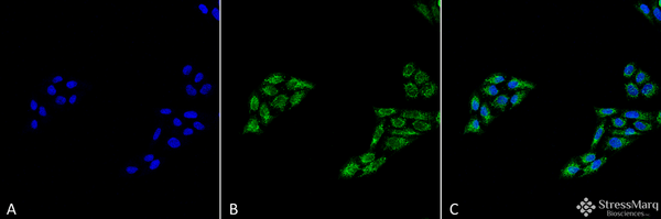 Rabbit Anti-p53 Antibody used in Immunocytochemistry/Immunofluorescence (ICC/IF) on Cervical cancer cell line (HeLa) (SPC-682)