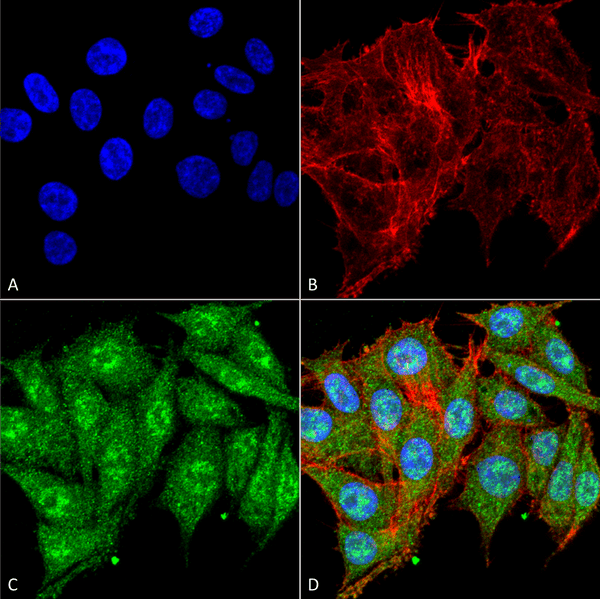 Rabbit Anti-IGF-1 Antibody used in Immunocytochemistry/Immunofluorescence (ICC/IF) on Colon carcinoma cell line (RKO) (SPC-699)