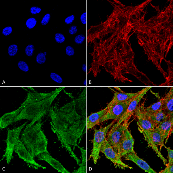 Rabbit Anti-Kir4.1 Antibody used in Immunocytochemistry/Immunofluorescence (ICC/IF) on Colon carcinoma cell line (RKO) (SPC-700)