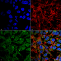 Rabbit Anti-BDNF Antibody used in Immunocytochemistry/Immunofluorescence (ICC/IF) on Neuroblastoma cell line (SK-N-BE) (SPC-703)