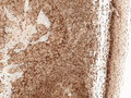Rabbit Anti-CCR2 Antibody used in Immunohistochemistry (IHC) on Tonsil (SPC-704)