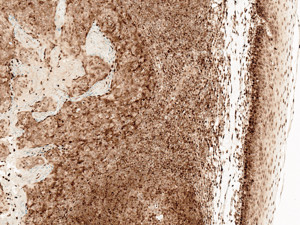 Rabbit Anti-CCR2 Antibody used in Immunohistochemistry (IHC) on Tonsil (SPC-704)